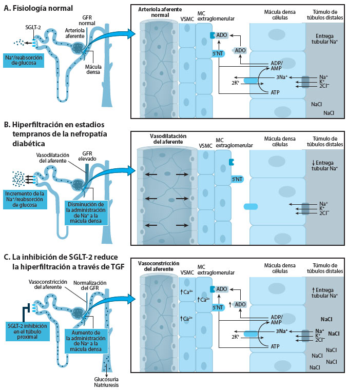 Figura 2. Mecanismo del feedback tubuloglomerular