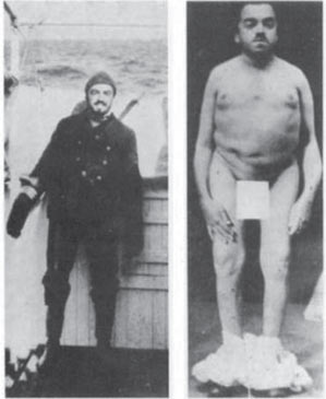 Figura 5. El capitán Martell, antes y después de su enfermedad