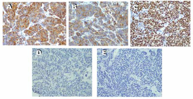 Figura 3. Biopsia hepática