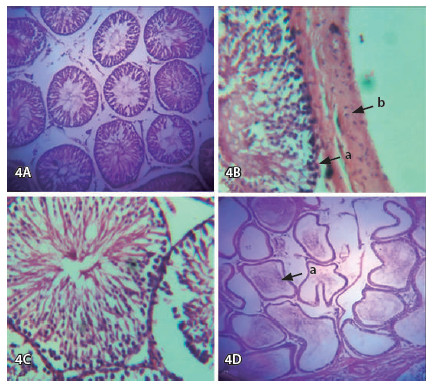 Figura 4. Fotografías de algunos cortes del estudio histopatológico (tinción con hematoxilina-eosina) de testículos