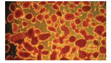 Figura 5. Microfotografía de islotes pancreáticos con tinción de ditizona (aumento 10X)